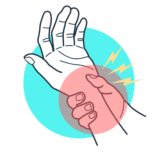 graphic illustration of carpel tunnel syndrome pain