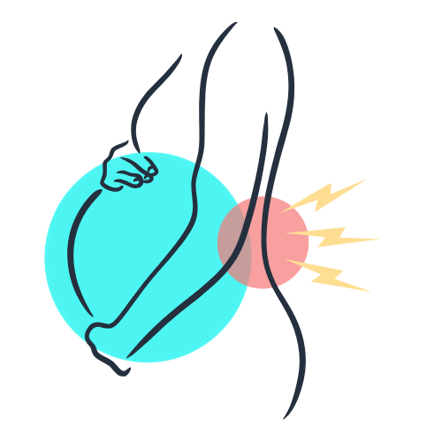 graphic illustration of pregnancy back pain