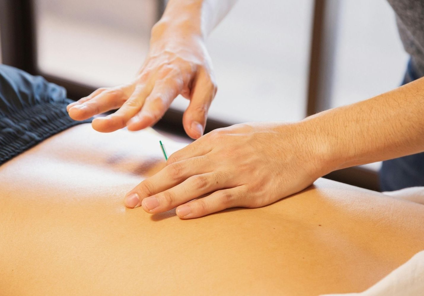 Photo of dry needling to a patient's back